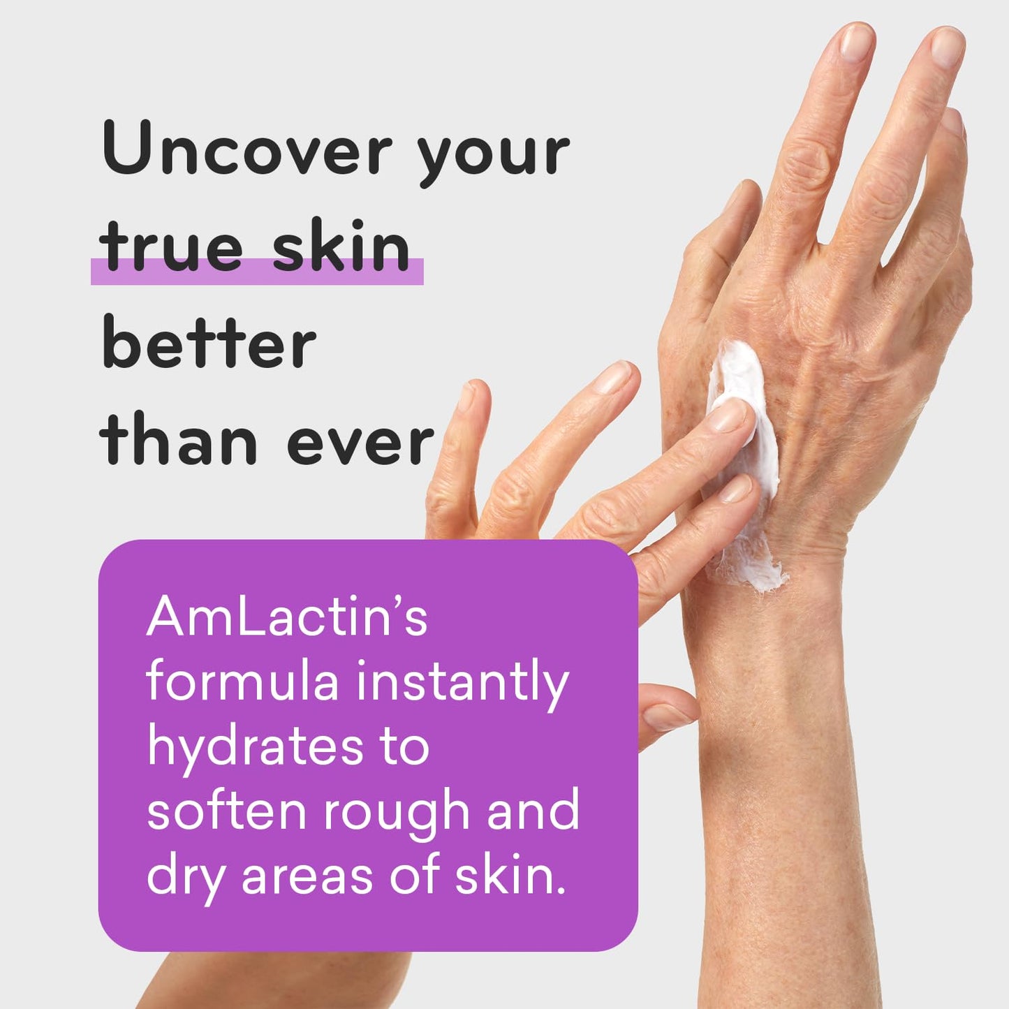 AmLactin Ultra Smoothing - 4.9 oz Body & Hand Cream with 15% Lactic Acid - Exfoliator and Moisturizer for Rough and Bumpy Dry Skin (Packaging May Vary) C3