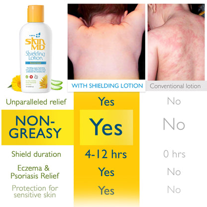 Skin MD Shielding Lotion for Face, Body & Hands 4oz + SPF 15 - Helps with Eczema & Psoriasis! The dry skin remedy to the things that dry your skin C3